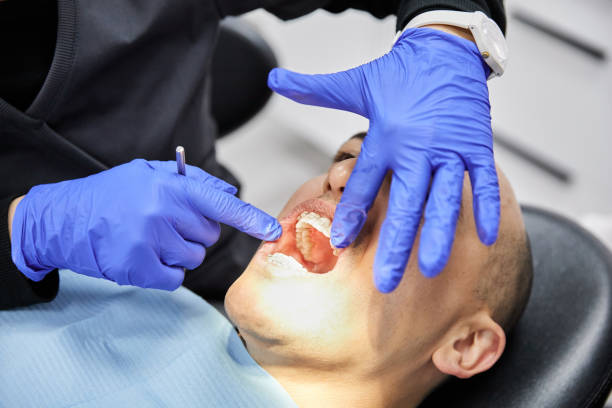 Best Emergency Dentist for Lost Fillings or Crowns in Burlington, ND